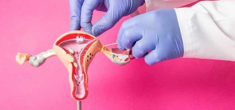 Gynaec Oncological Surgery Image